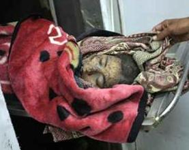 Anak korban bom Israel (IMEMC)