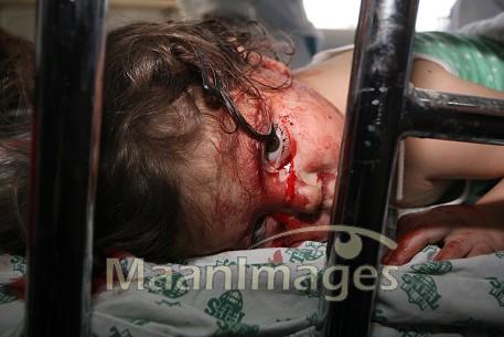 Israel tak pilih-pilih sasaran (foto: gazanews wordpress.com)