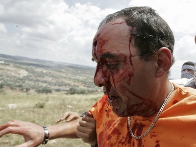 23.7.2010, AV, Peserta unjuk rasa luka-luka, 4892 Salah satu peserta unjuk rasa yang luka parah akibat serangan brutal aparat Zionis (foto: av)