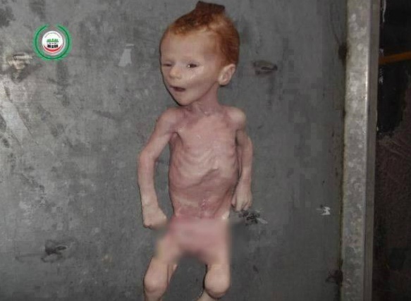 Seorang bayi meninggal kelaparan di kamp pengungsi Yarmouk, Suriah, yang telah berbulan-bulan dikepung rezim Assad. Foto: Revolution Syria