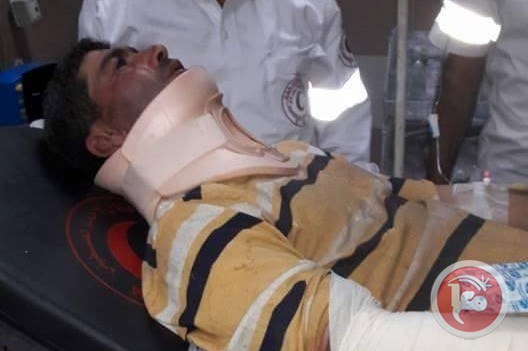 Jaber Barakat Abu Fekheideh dirawat di sebuah rumah sakit Ramallah karena terluka parah setelah diserang pemukim ilegal Yahudi. Foto: MaanImages 