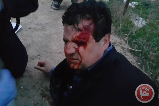 Anggota parlemen Knesset, Ayman Odeh, terluka akibat peluru berlapis karet yang ditembakkan penjajah Zionis ke kepalanya. Foto: Ma’an News Agency