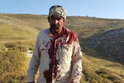 Penggembala Palestina Mamoun Amin Nassar usai diserang para pemukim ilegal Yahudi pada 27 Mei 2017 di Madama, Tepi Barat. Foto: Zakariya Sada, peneliti lapangan lembaga Rabbis for Human Rights