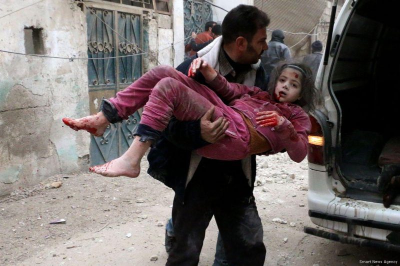 Seorang bocah perempuan Suriah terluka parah setelah rezim Assad melancarkan serangan udara di Ghouta Timur, Suriah, pada 23 Februari 2018. Foto: Smart News Agency