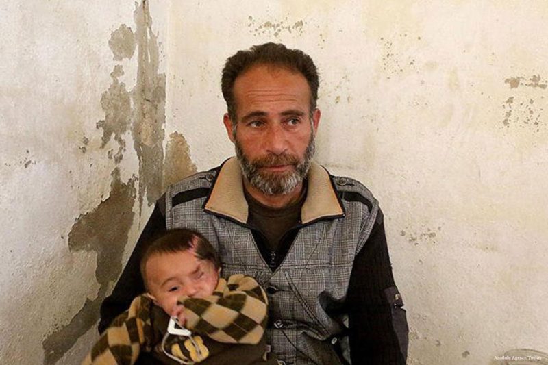 Bayi Suriah, Karim –yang kehilangan satu mata akibat serangan udara rezim– dan ayahnya berlindung di bawah tanah untuk bertahan dari konflik yang terus berlangsung di Suriah. Foto: Anadolu Agency/Twitter